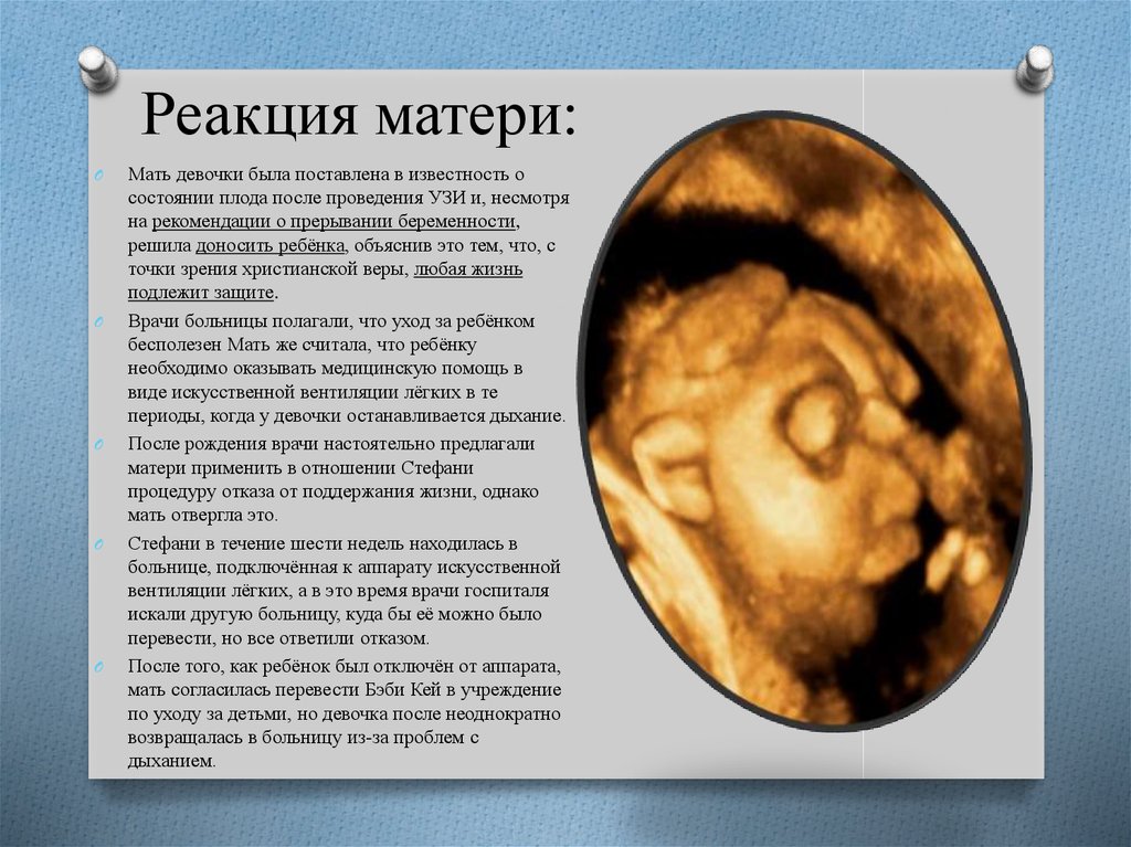 Реакция матери: