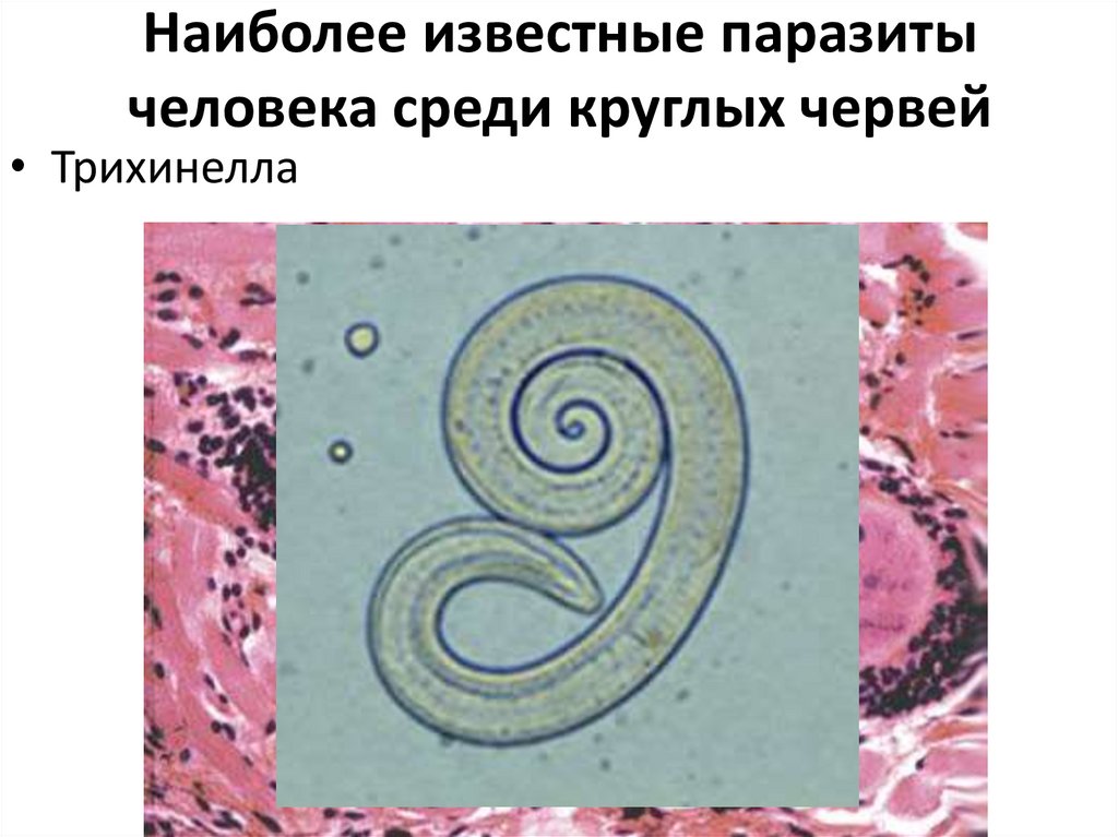 Органах чувств паразитических червей. Круглые черви паразиты человека презентация. Простейшие паразиты человека. Круглые черви паразиты человека животных и растений.