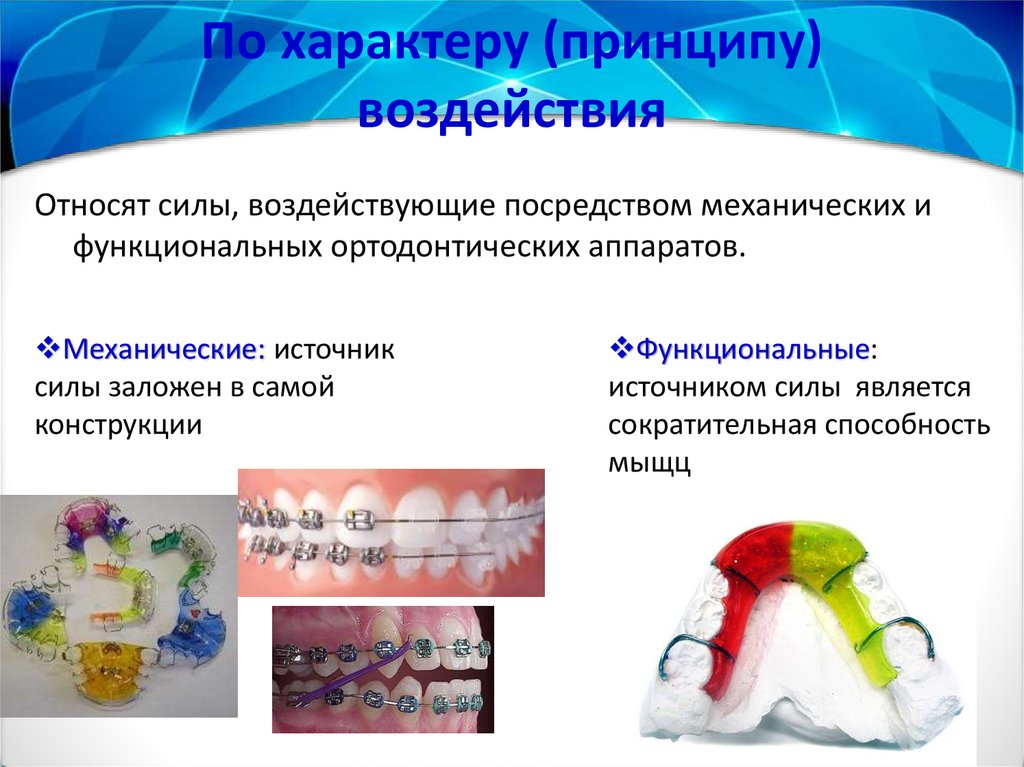 Ортодонтические аппараты механического действия презентация