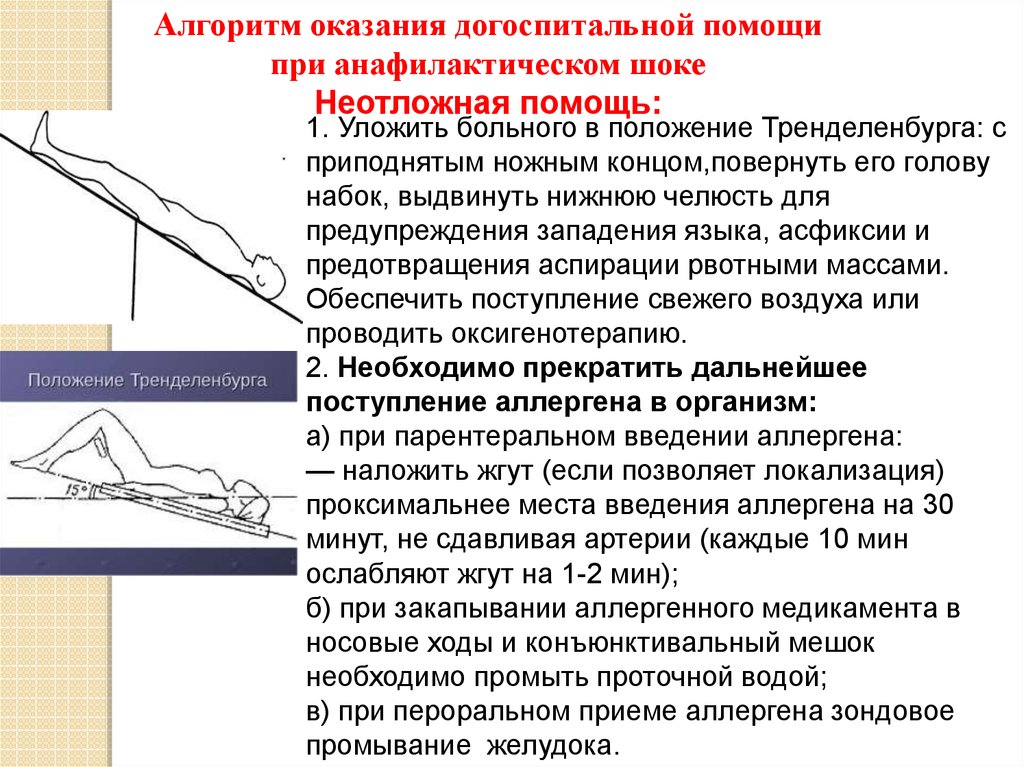 Какое горизонтальное положение. Положение Тренделенбурга при шоке. Положение Тренделенбурга при анафилактическом шоке. Положение трансленбврга. Положение транбельбурга.