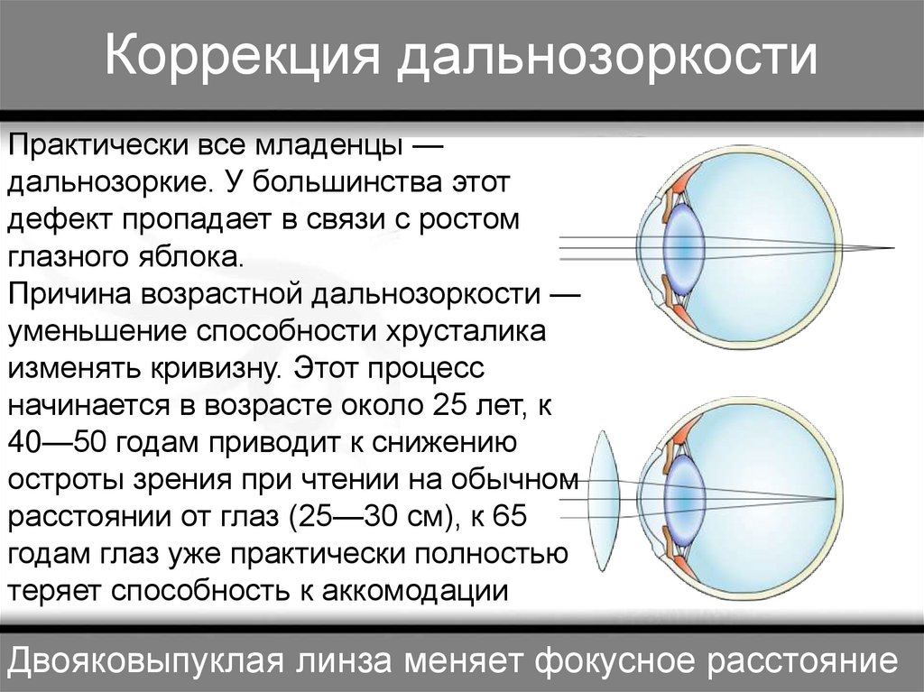 Глаз как оптическая система дефекты зрения и способы их исправления 8 класс презентация