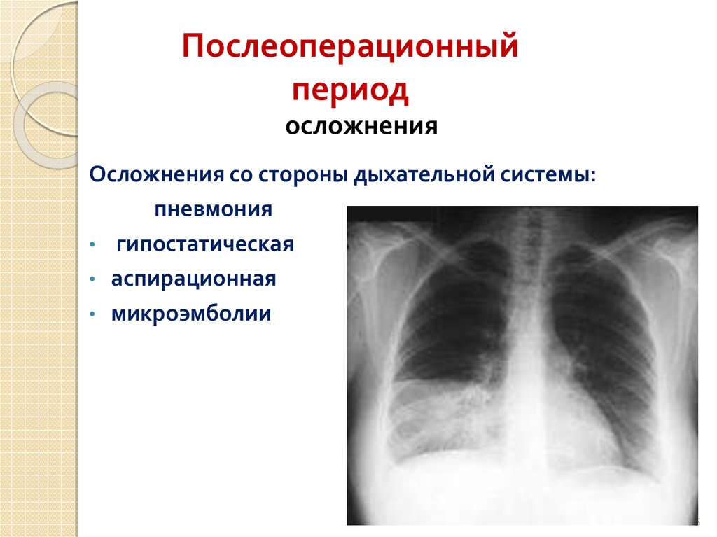 Гипостатические изменения в легких. Послеоперационные осложнения дыхательной системы. Осложнения дыхательной системы после операции. Послеоперационные осложнения со стороны дыхательной системы. Осложнения в послеоперационном периоде со стороны органов дыхания.