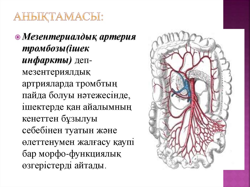 Тромбоз артерий мозга. Почему при тромбозе артерии происходит инфаркт.