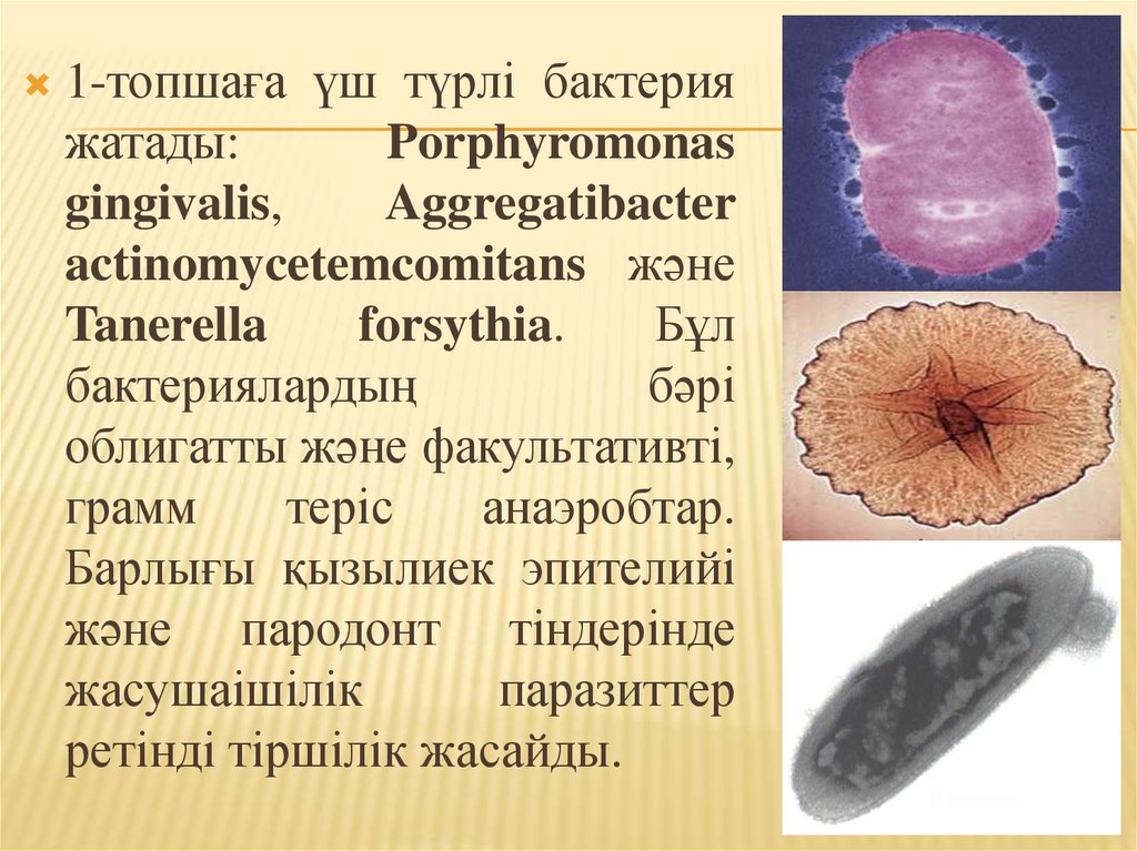 Porphyromonas gingivalis