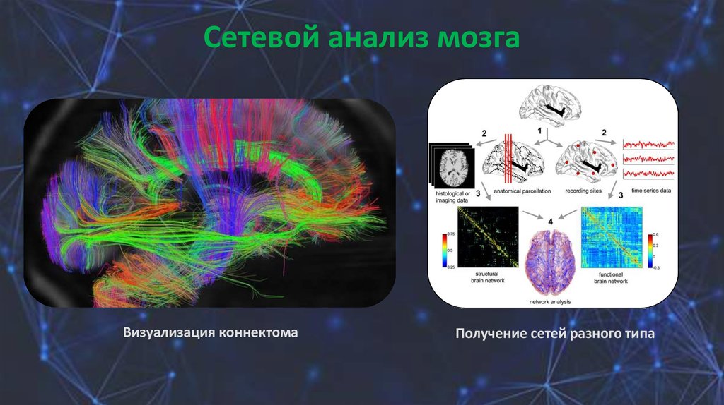 Сетевой анализ мозга