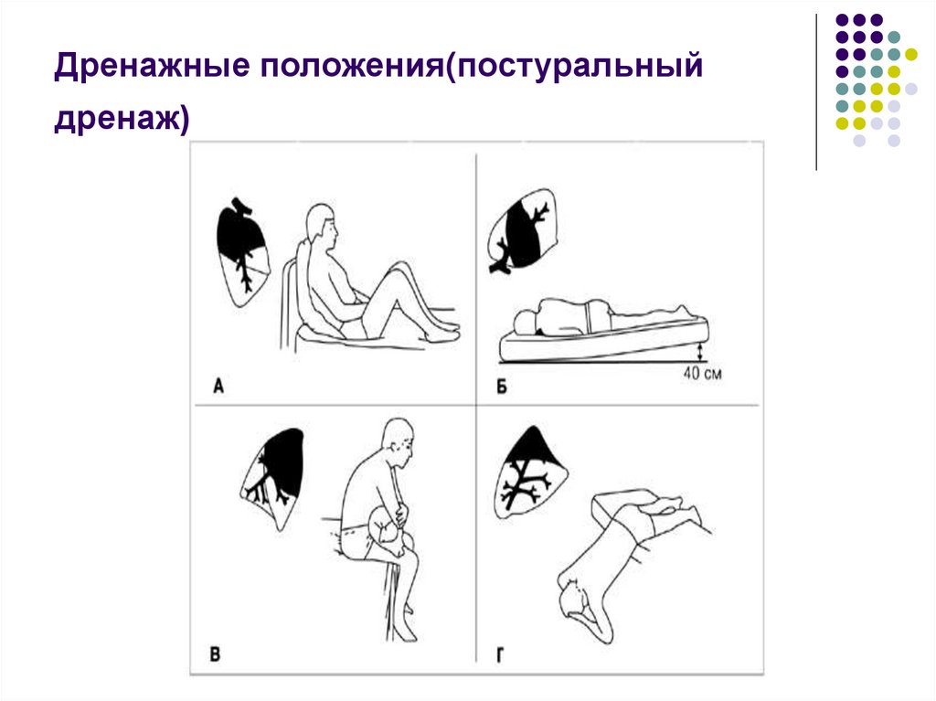 Дренажное положение. Постуральный дренаж памятка для пациента. Положение постурального дренажа. Дренирующие положения при заболеваниях органов дыхания. Постуральный дренаж и дренажную гимнастику.