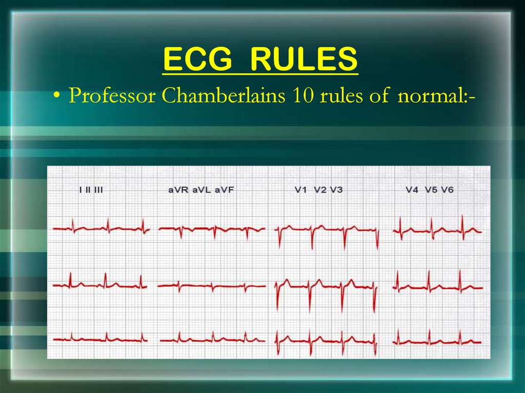 basics-of-ecg-online-presentation