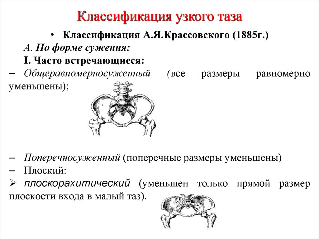 Презентация аномалии костного таза