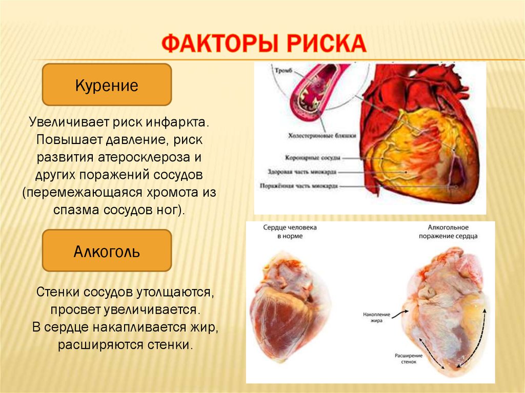 Сердечный комплекс