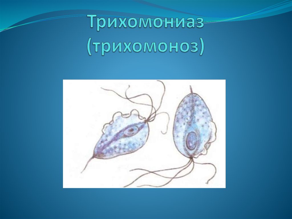 Трихомоноз у мужчин симптомы. Трихомоноз источник инфекции. Основные симптомы трихомоноза.