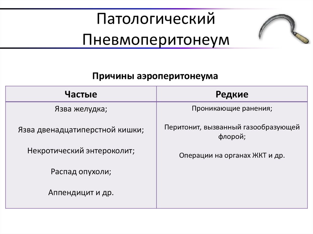 Патологический Пневмоперитонеум