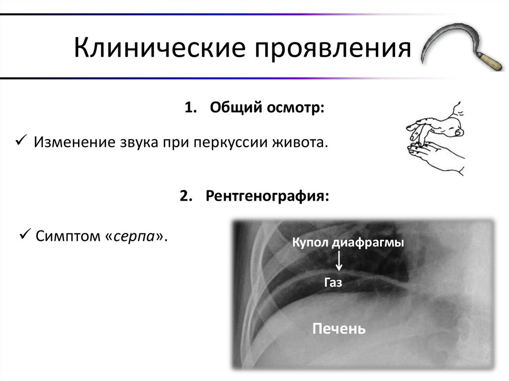 Клинические проявления