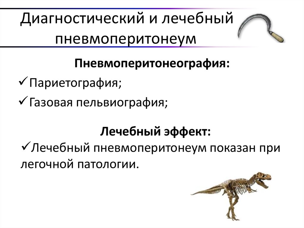 Диагностический и лечебный пневмоперитонеум