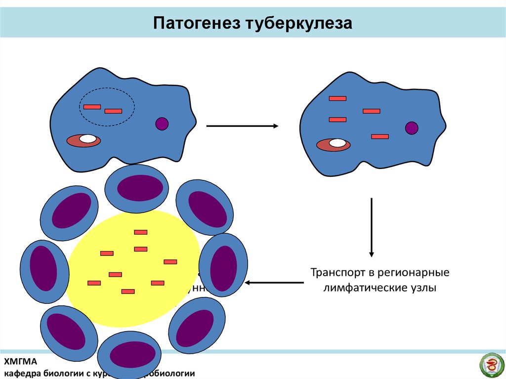 Туберкулез патогенез. Патогенез туберкулеза микробиология. Патогенез микобактерии. Фагоцитоз микобактерий туберкулеза. Туберкулез патогенез схема микробиология.