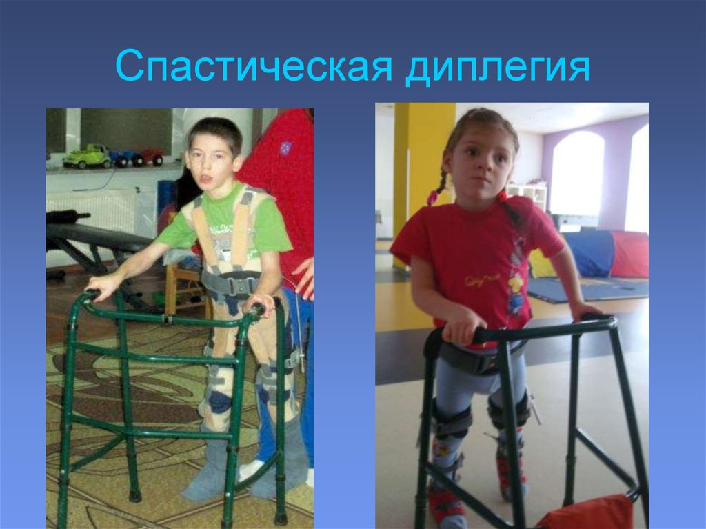 Знакомства Инвалидов С Дцп В Контакте Com