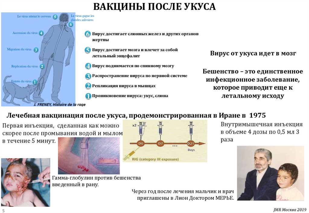 Схема вакцинации от бешенства для человека после укуса