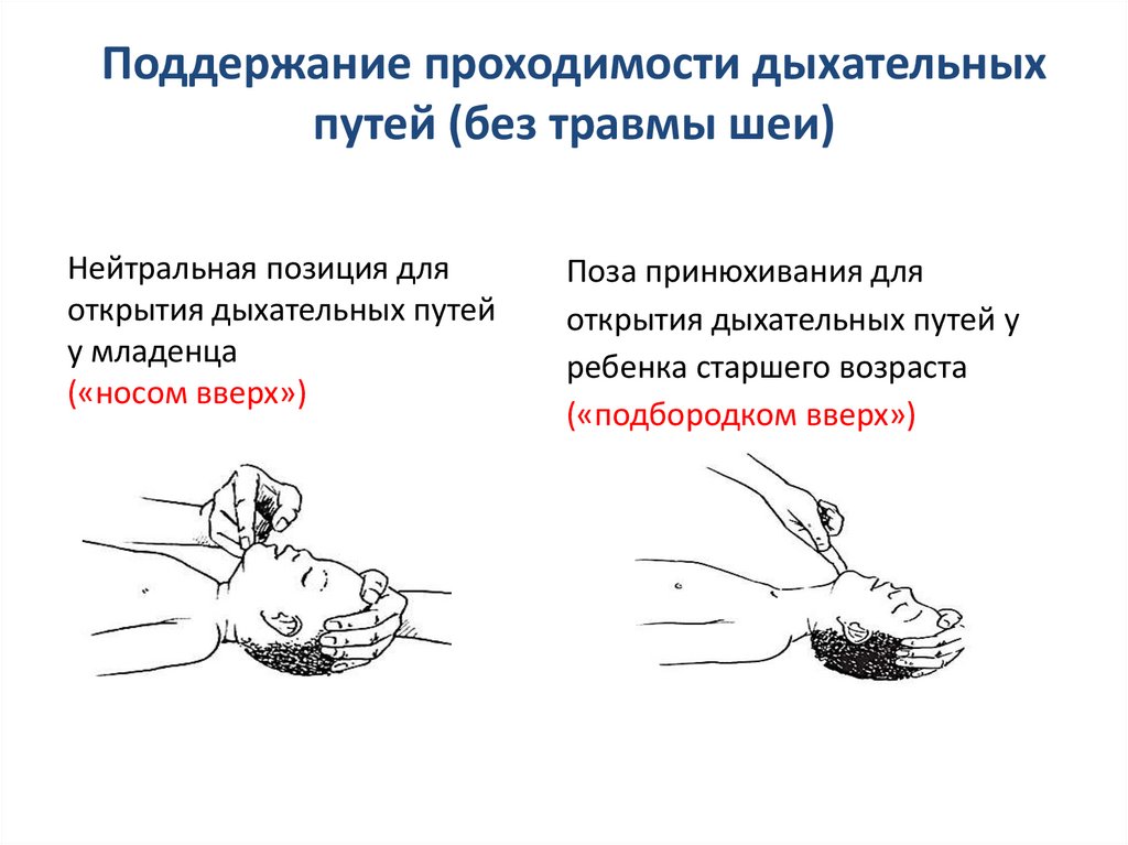 При нарушении проходимости верхних дыхательных путей. Поддержание свободной проходимости дыхательных путей. Способы обеспечения свободной проходимости дыхательных путей. Методы восстановления и поддержания проходимости дыхательных путей. Способы поддержания проходимости дыхательных путей.