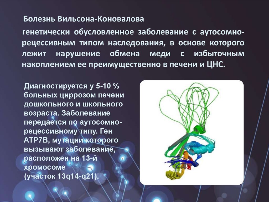 Болезнь вильсона коновалова клиническая картина