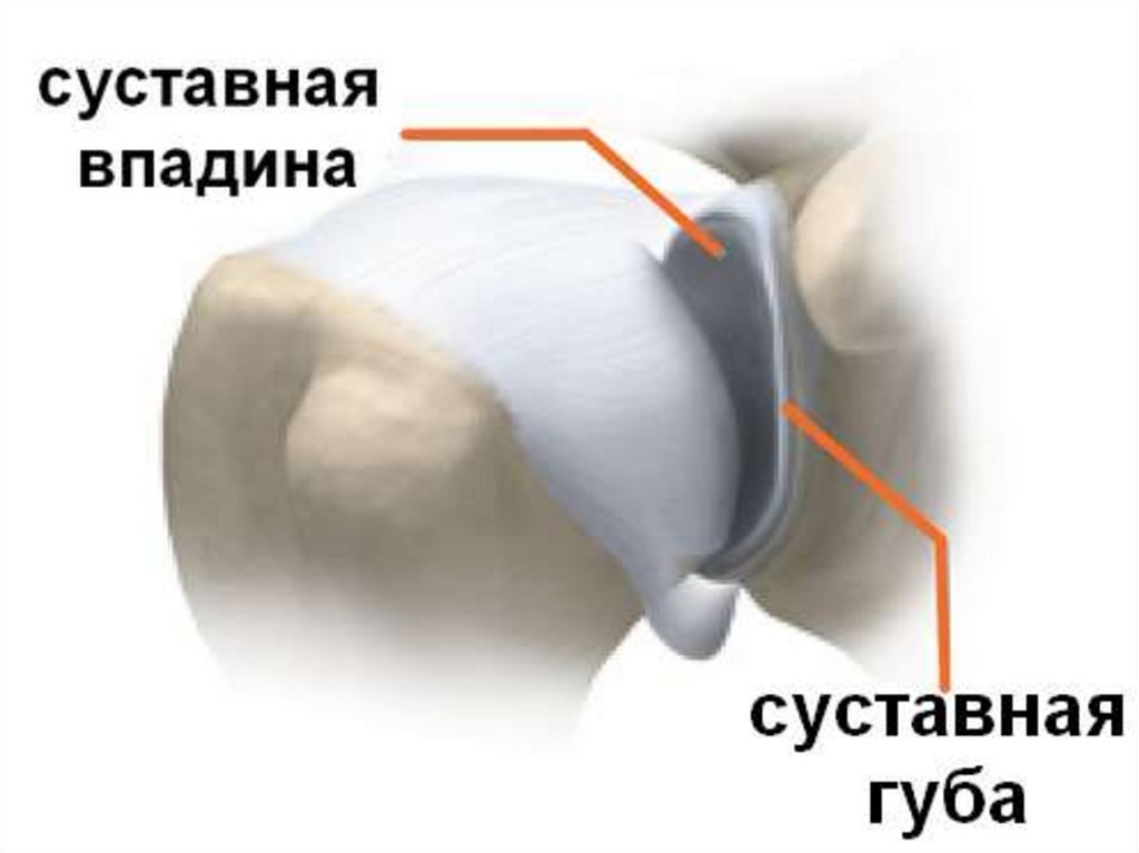 Разрыв губы гленоида. Суставная губа плечевого сустава анатомия. Фиброзно-хрящевая губа гленоида плечевого сустава. Суставная губа плечевого сустава анатомия мрт. Хрящевая суставная губа плечевого сустава.