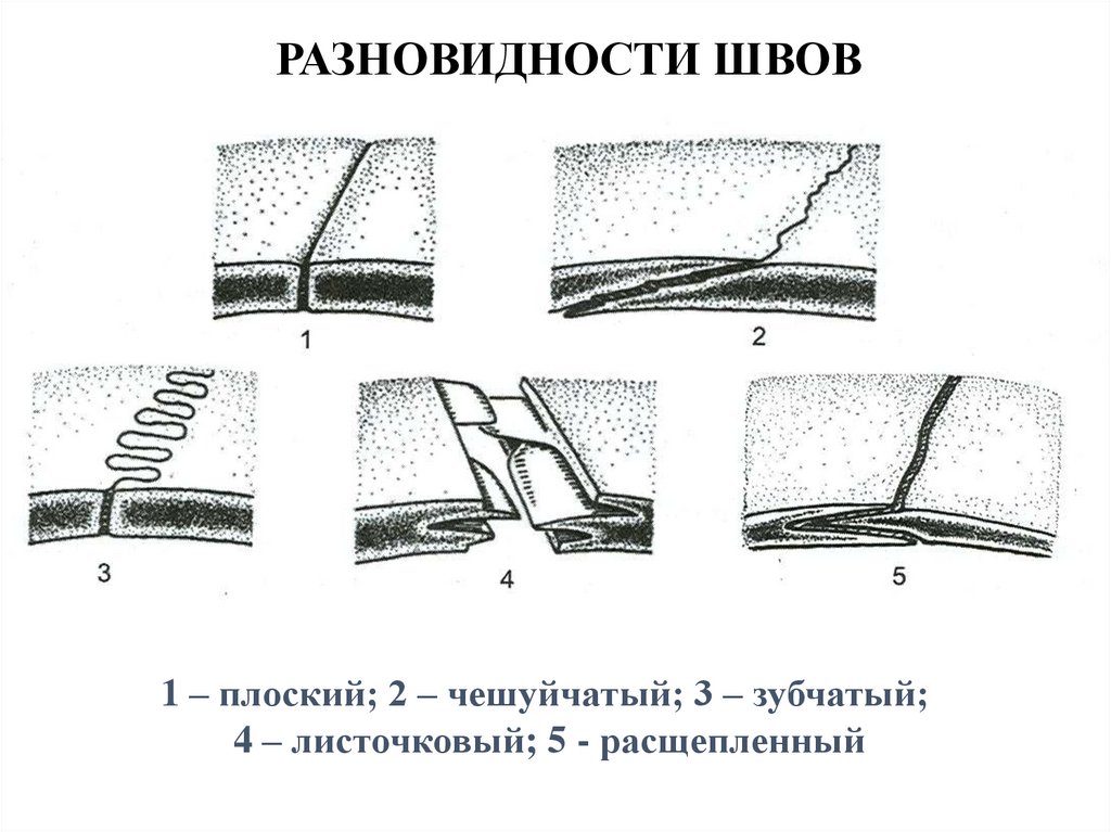 Шов кость