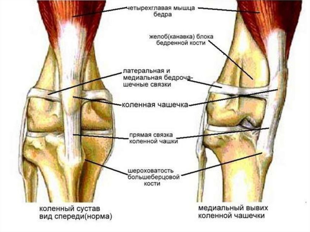 Боль под коленом спереди. Анатомия коленного сустава собаки. Строение колена надколенник. Коленный сустав строение анатомия. Пателла коленного сустава собаки.