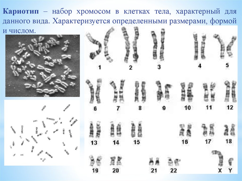 Хромосомы живых клеток. Кариотип совокупность признаков набора хромосом. Хромосомный набор клетки кариотип. Хромосомный набор кариотип человека. Кариотип: 46, r 18.