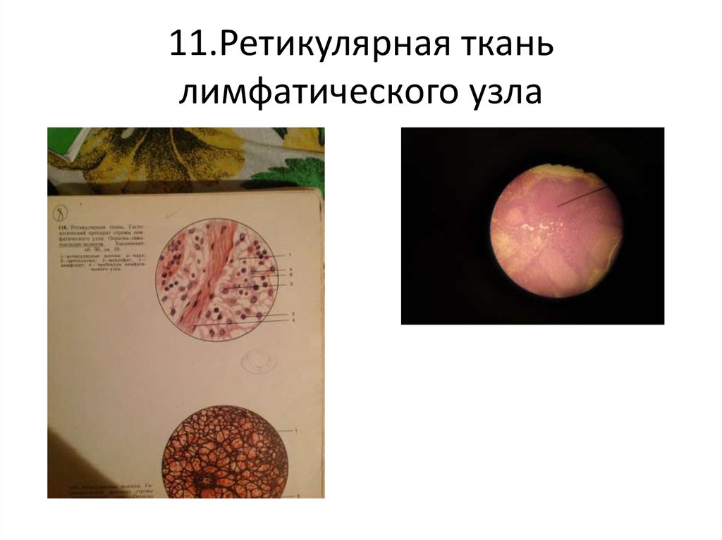 11.Ретикулярная ткань лимфатического узла