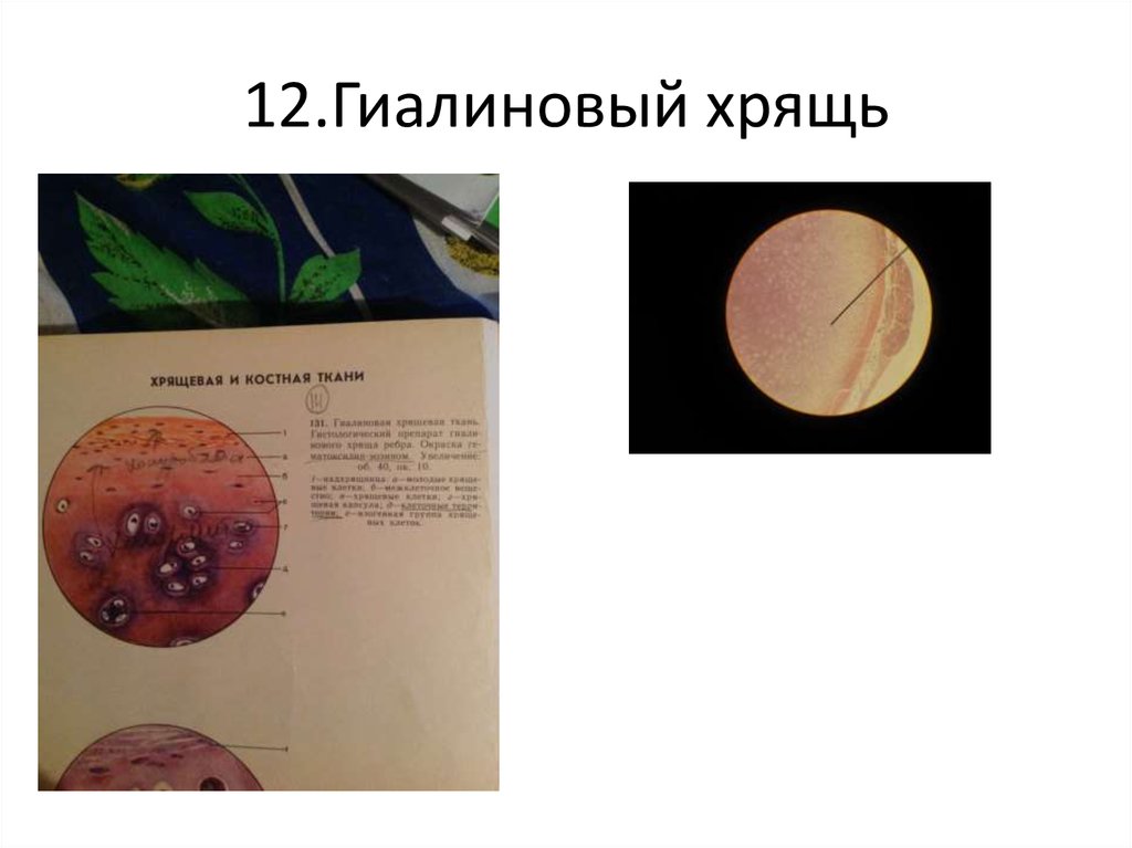 12.Гиалиновый хрящь