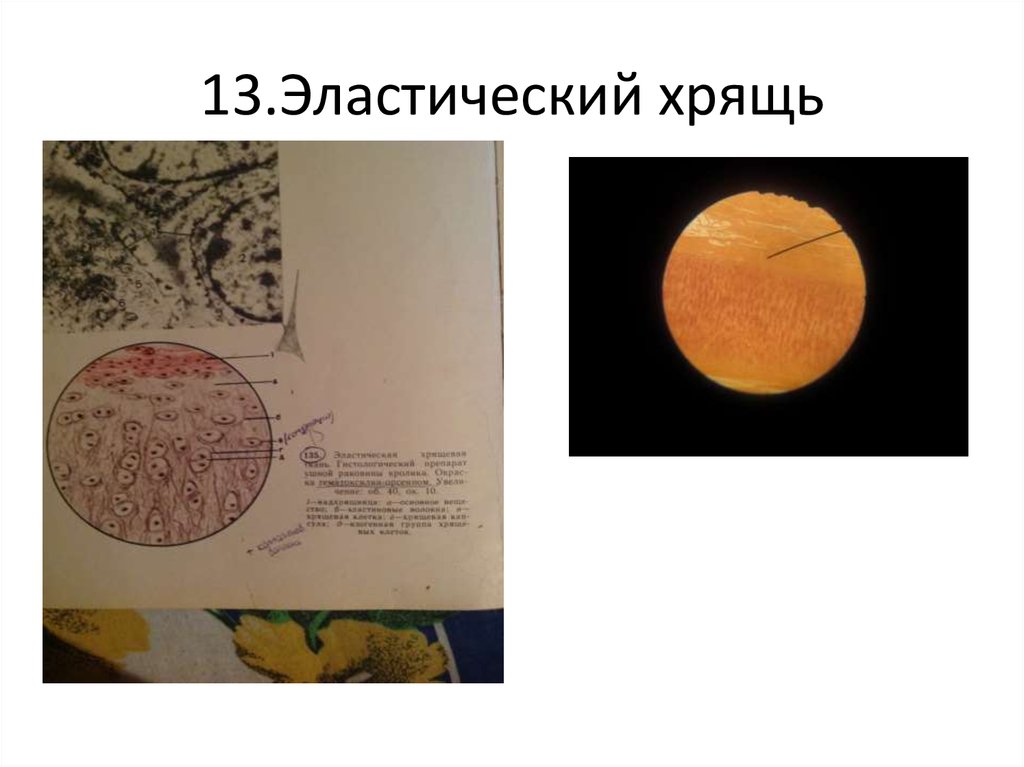 13.Эластический хрящь