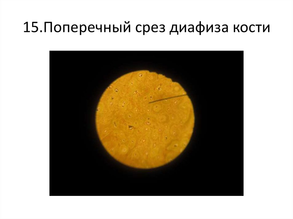 15.Поперечный срез диафиза кости