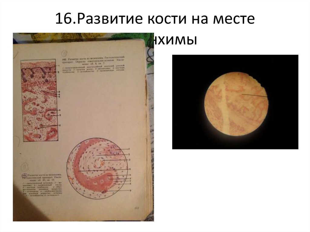 16.Развитие кости на месте мезенхимы