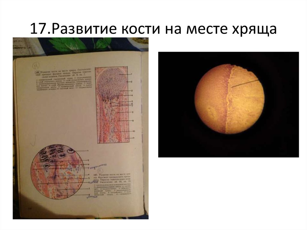 Развитие кости на месте хряща рисунок