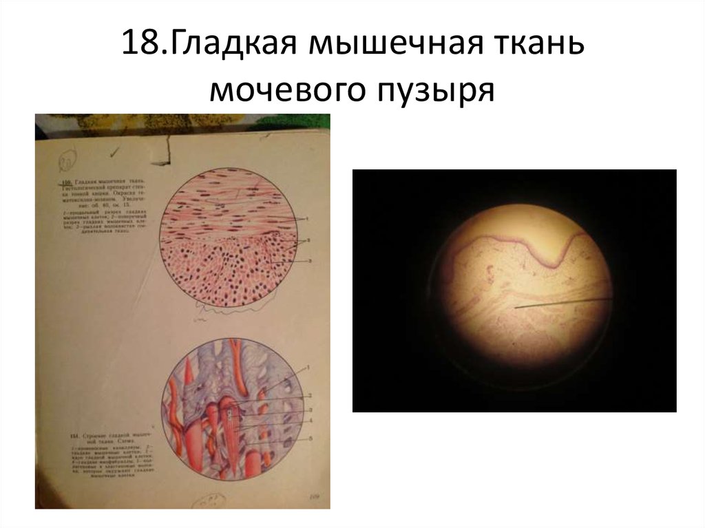 Гладкая ткань мочевого пузыря. Гладкая мышечная ткань мочевого пузыря препарат. Гладкая мышечная ткань мочевого пузыря гистология. Гладкая мышечная ткань стенки мочевого пузыря. Мышечная ткань мочевого пузыря.