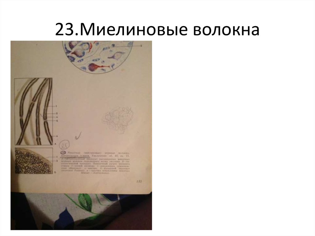 23.Миелиновые волокна