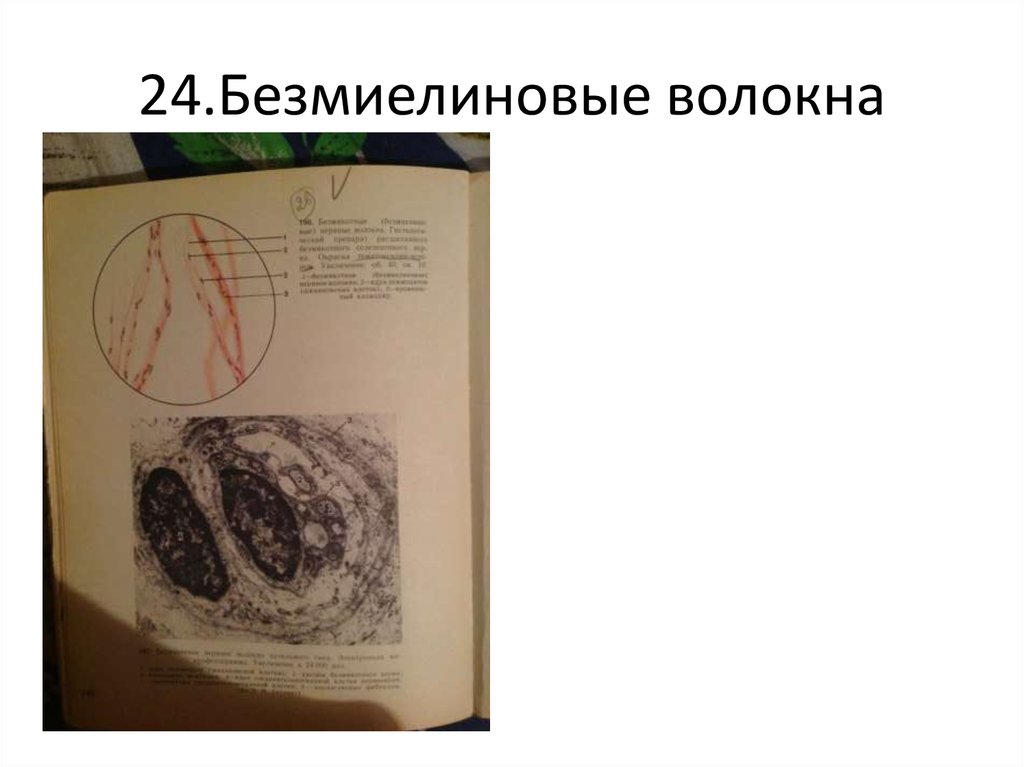 24.Безмиелиновые волокна