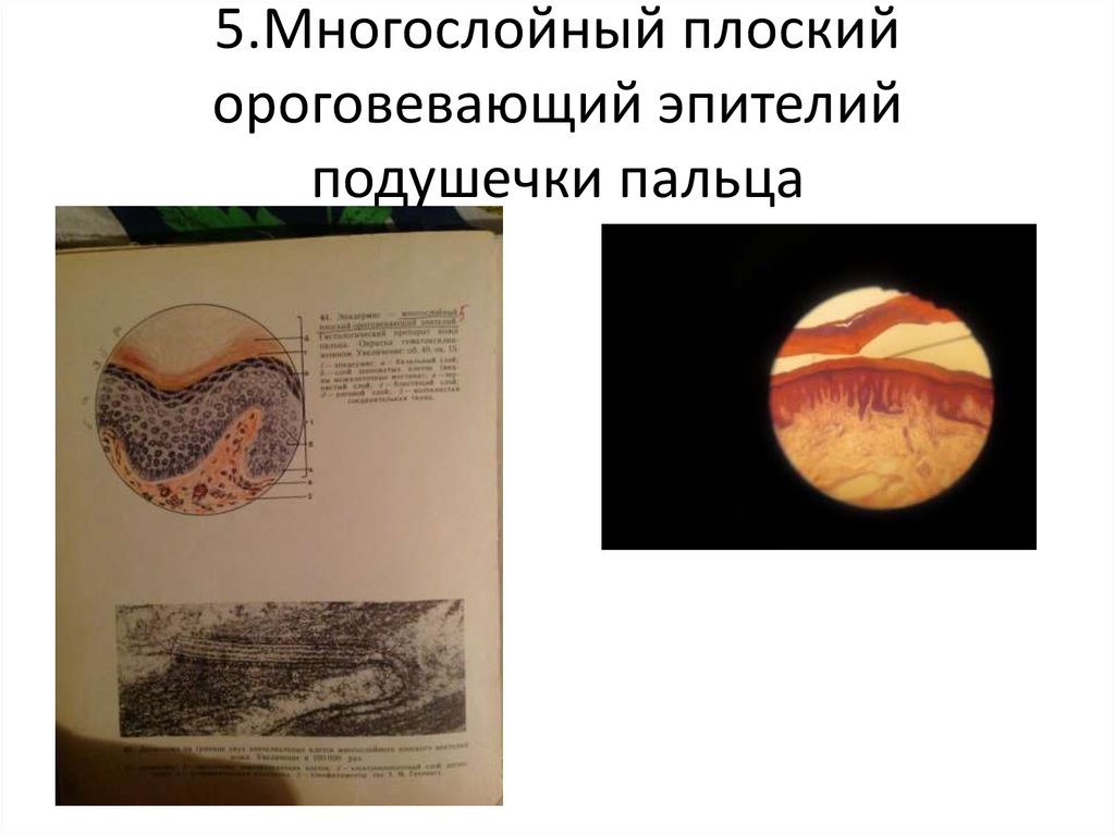 5.Многослойный плоский ороговевающий эпителий подушечки пальца