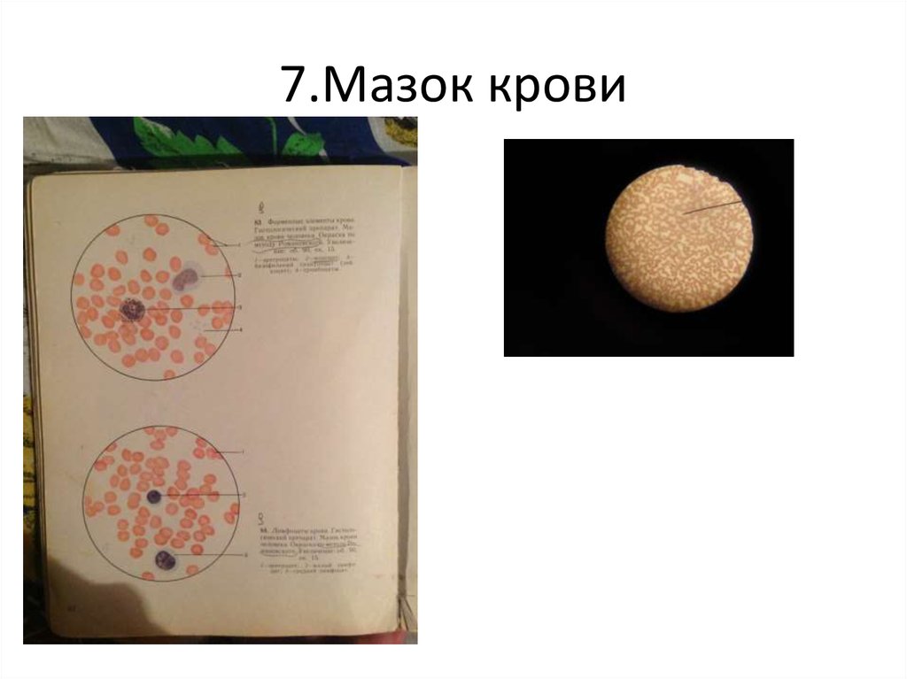 7.Мазок крови