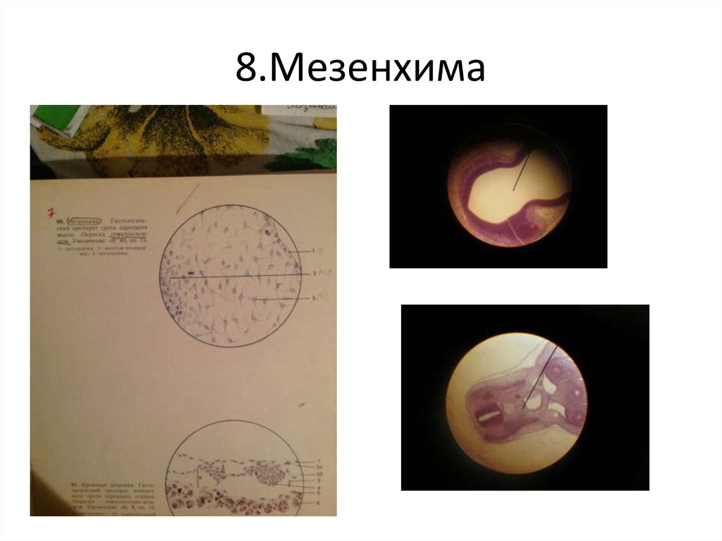 Мезенхима. Мезенхима зародыша курицы гистология. Мезенхима зародыша гистология препарат. Мезенхима зародыша цыпленка препарат гистология. Мезенхима зародыша курицы препарат.