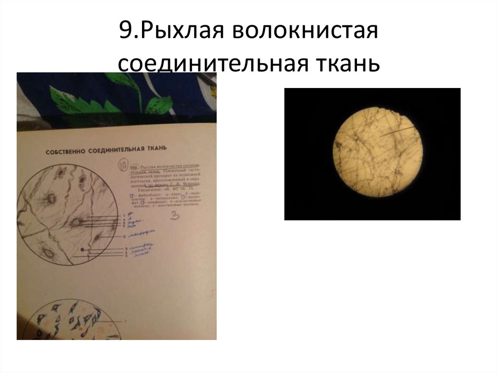 9.Рыхлая волокнистая соединительная ткань