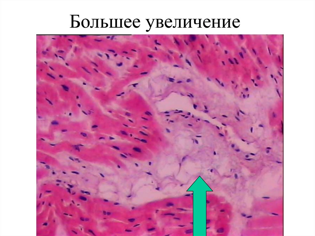 Большее увеличение