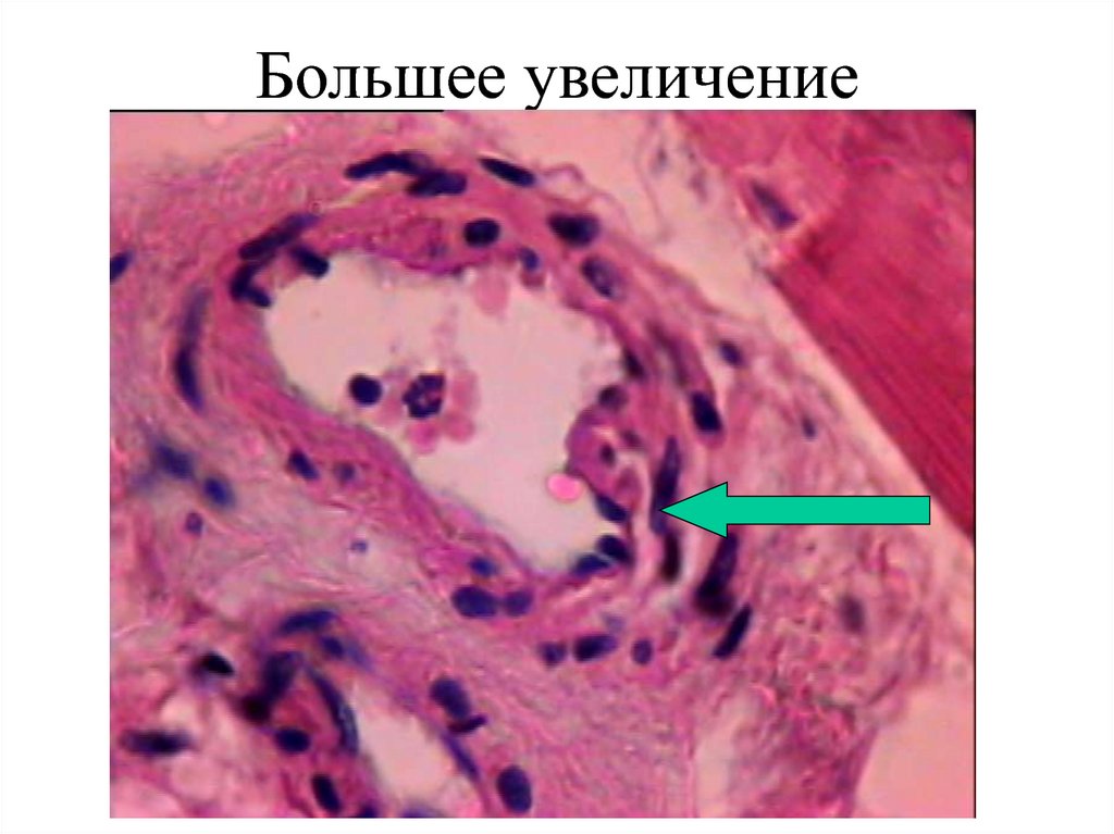 Большее увеличение