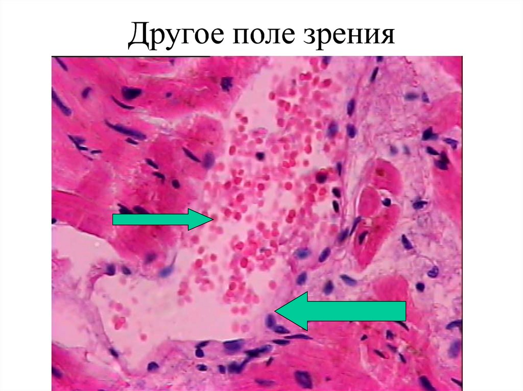 Другое поле зрения