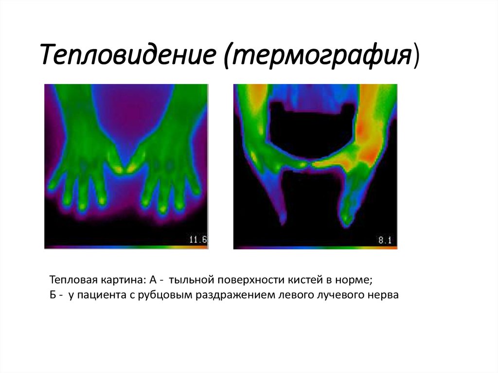 Характеристики теплового излучения термография презентация