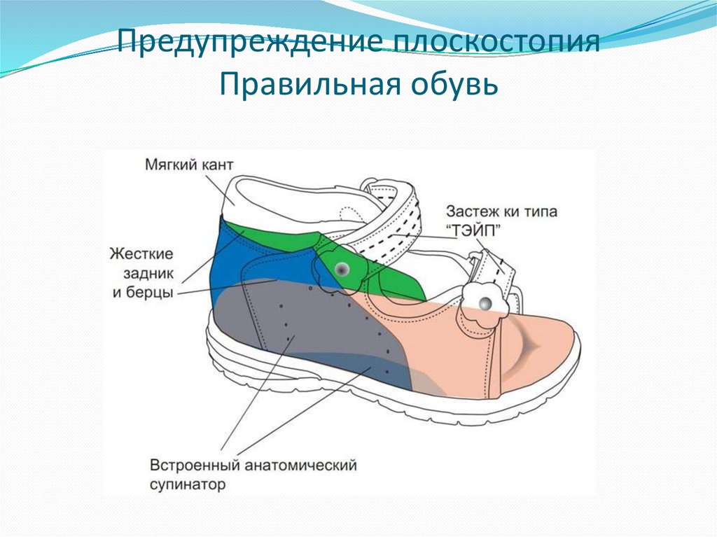 Предупреждение плоскостопия Правильная обувь