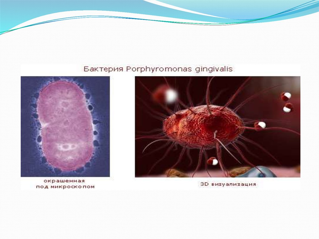 Porphyromonas gingivalis. Порфиромонады. Porphyromonas gingivalis микробиология. Порфиромонады род Porphyromonas. Porphyromonas gingivalis относят к микроорганизмам.