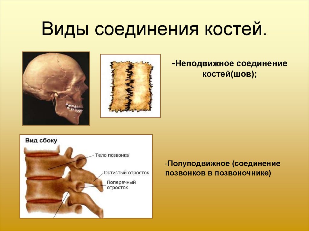 Полуподвижные кости пример. Полуподвижное соединение костей. Типы соединения костей неподвижное и полуподвижное. Тип соединения полуподвижное. Неподвижное соединение костей.