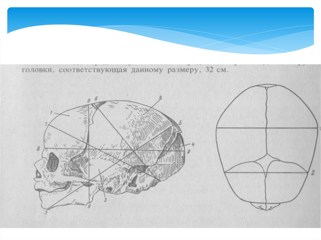 Прямой размер головки плода
