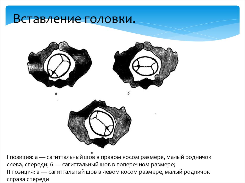 Правая позиция