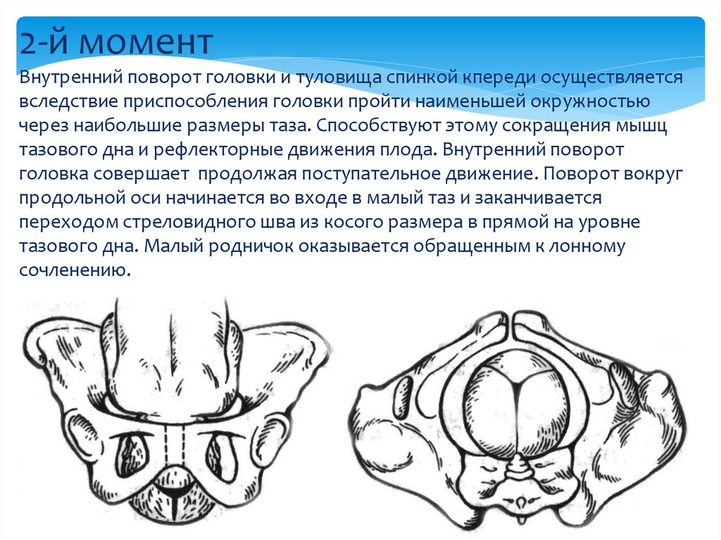 Размеры головки таза. Внутренний поворот головки. Внутренний поворот головки затылком кпереди. Размеры таза и головки плода. Задний вид затылочного предлежания биомеханизм.