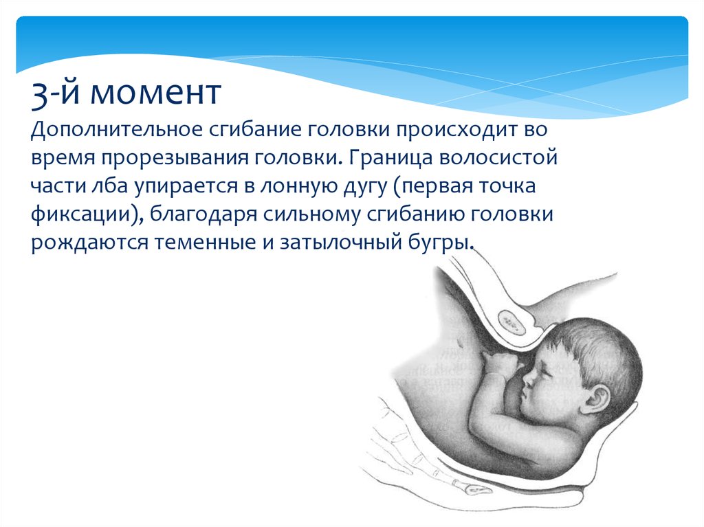 Путь ребенка во время родов. Передний вид затылочного предлежания. Затылочное предлежание биомеханизм. При заднем виде затылочного предлежания. Роды в переднем виде затылочного предлежания.